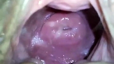 my japanese girlfend's cute cervix in huge hole